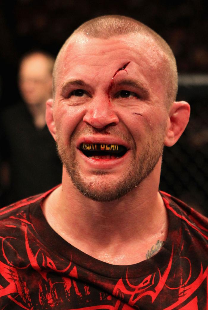 Chris Lytle after his loss to Ebersole