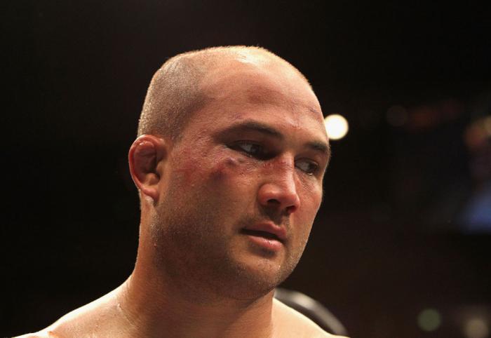 BJ Penn reacts to the decision.