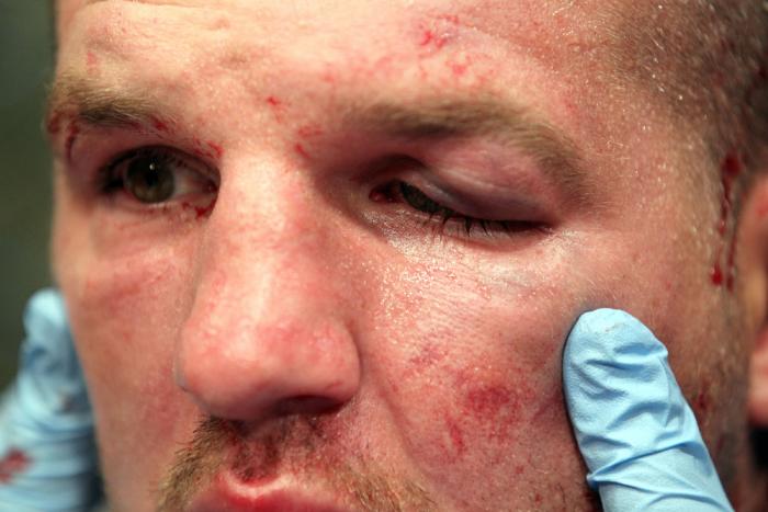 UFC 133: Matt Hamill