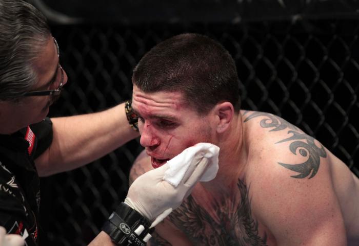 Chris Camozzi