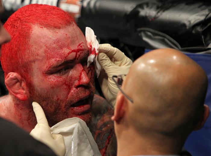 Chris Leben after the fight