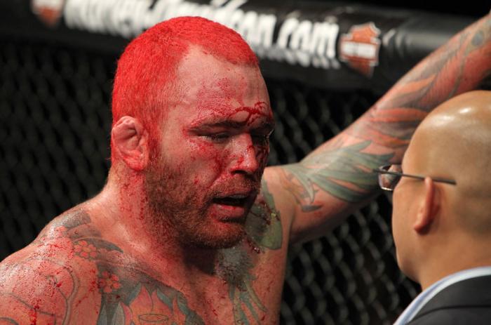 Chris Leben after the fight