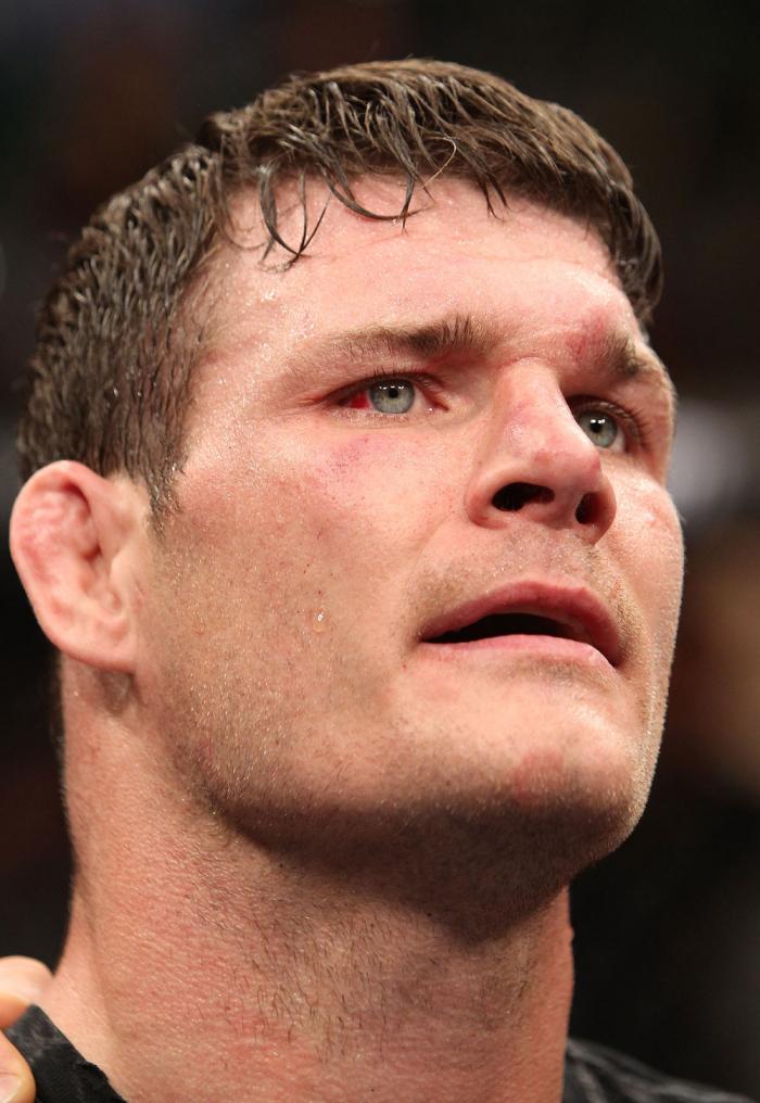 Michael Bisping