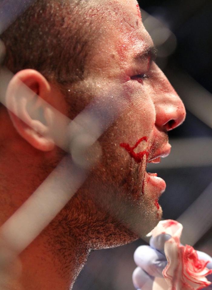 TORONTO, ON - DECEMBER 10: John Makdessi reacts after suffering a defeat to Dennis Hallman during the UFC 140 event at Air Canada Centre on December 10, 2011 in Toronto, Ontario, Canada. (Photo by Nick Laham/Zuffa LLC/Zuffa LLC via Getty Images)