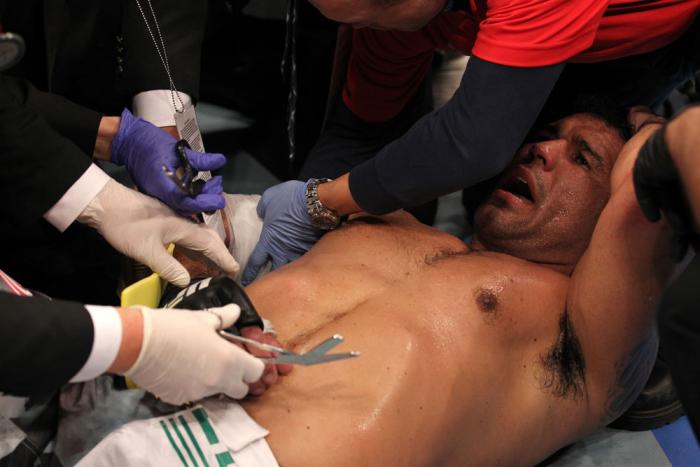 TORONTO, ON - DECEMBER 10: Antonio Rodrigo Nogueira receives treatment from the doctors after suffering a separated shoulder against Frank Mir during the UFC 140 event at Air Canada Centre on December 10, 2011 in Toronto, Ontario, Canada. (Photo by Nick