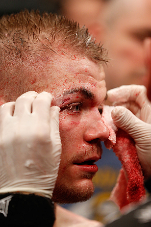 LONDON, ENGLAND - FEBRUARY 16: Michael McDonald is treated by a cut man after his loss to Renan Barao in their interim bantamweight title fight during the UFC on Fuel TV event on February 16, 2013 at Wembley Arena in London, England. (Photo by Josh Hedg