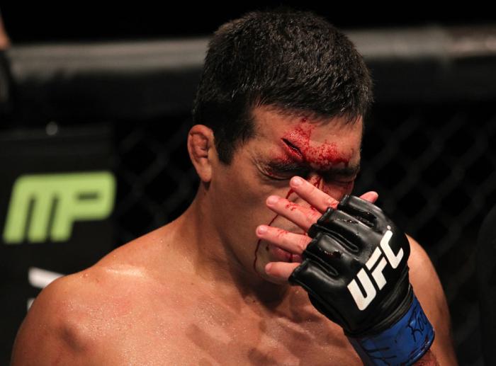 TORONTO, ON - DECEMBER 10: Lyoto Machida wipes blood from his face during his bout agaisnt Jon Jones during the UFC 140 event at Air Canada Centre on December 10, 2011 in Toronto, Ontario, Canada. (Photo by Nick Laham/Zuffa LLC/Zuffa LLC via Getty Image