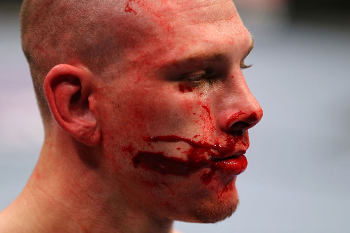 NEWARK, NJ - APRIL 27: Kurt Holobaugh looks on in in his featherweight bout against Steven Siler during the UFC 159 event at the Prudential Center on April 27, 2013 in Newark, New Jersey. (Photo by Al Bello/Zuffa LLC/Zuffa LLC Via Getty Images)