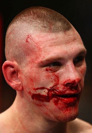 NEWARK, NJ - APRIL 27: Kurt Holobaugh smiles in in his featherweight bout against Steven Siler during the UFC 159 event at the Prudential Center on April 27, 2013 in Newark, New Jersey. (Photo by Al Bello/Zuffa LLC/Zuffa LLC Via Getty Images)