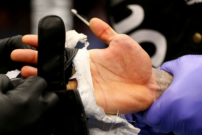NEWARK, NJ - APRIL 27: Yancy Medeiros has his injured hand looked at by a doctor during a stoppage in his lightweight bout against Rustam Khabilov of Russia during the UFC 159 event at the Prudential Center on April 27, 2013 in Newark, New Jersey. (Photo