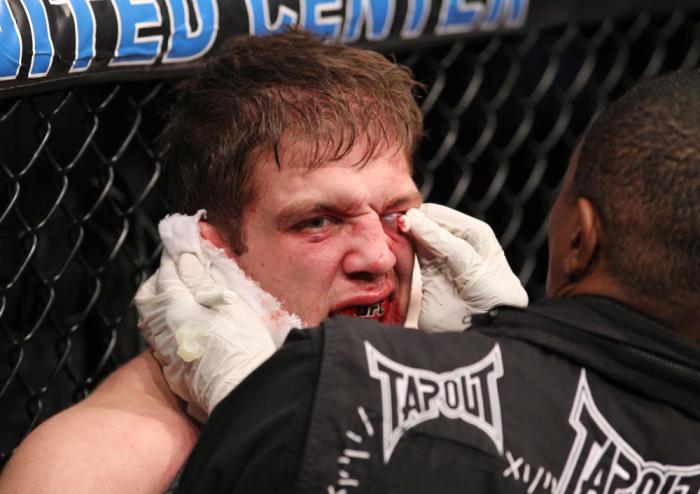 CHICAGO, IL - JANUARY 28: Nik Lentz is treated for a cut during his bout against Evan Dunham during the UFC on FOX event at United Center on January 28, 2012 in Chicago, Illinois. (Photo by Nick Laham/Zuffa LLC/Zuffa LLC via Getty Images) *** Local Capt