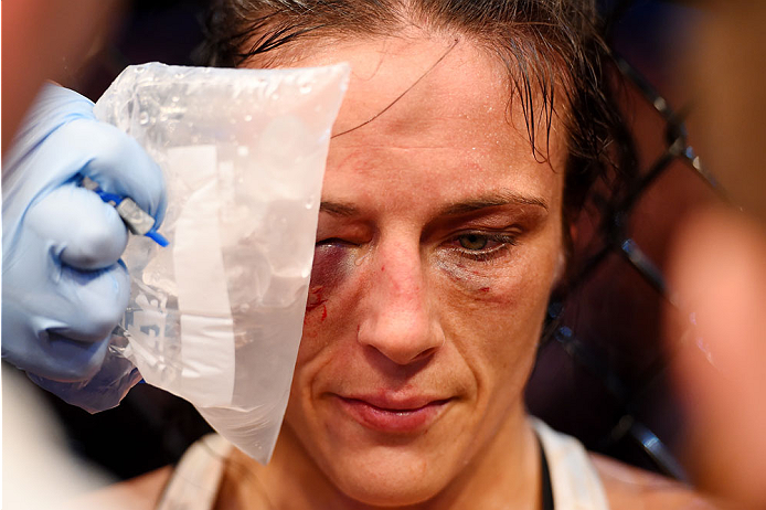 MELBOURNE, AUSTRALIA - NOVEMBER 15: Valerie Letourneau has an ice pack held to her head during a break in her fight against Joanna Jedrzejczyk (not pictured) in their UFC women's strawweight championship bout during the UFC 193 event at Etihad Stadium on